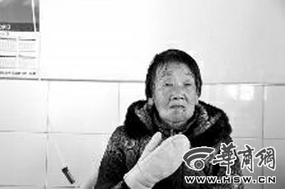 事发5日后，受伤的李群玲下巴处仍能看到被咬的伤痕