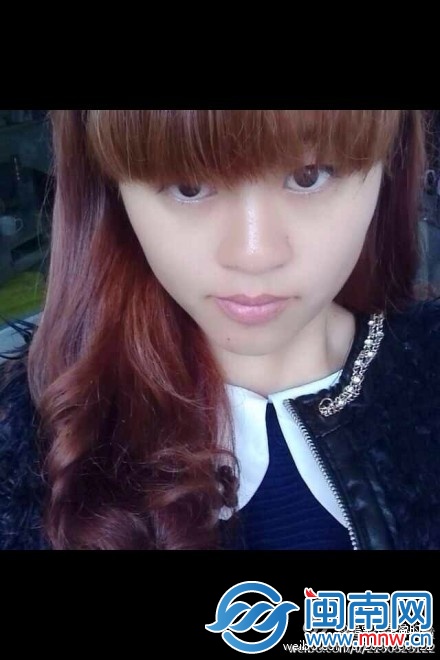 女儿烧伤前照片