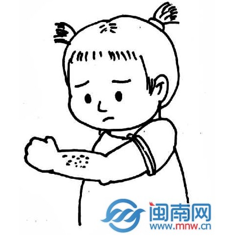 笔炱澜甏 注意个人卫生可预防