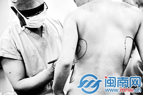 女子为挽留出轨丈夫隆胸 12年后前胸跑到后背