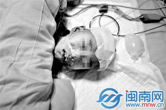 ICU里的小涛