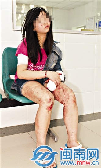 少女在仁福骨外科医院治疗