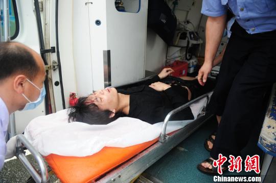 受伤的驾驶员左腿骨折严重
