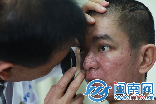 医生建议丁山做脑部CT，才能确定眼睛有何问题