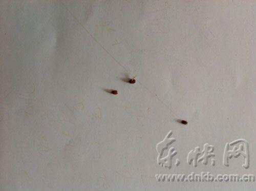 什么虫子会钻进眼睛 312346_201406201621281qBT8.jpg