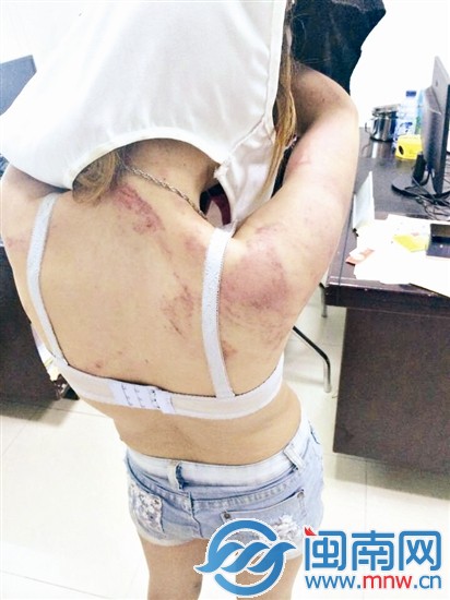 黄某在女警面前脱下衣服,身上伤痕累累