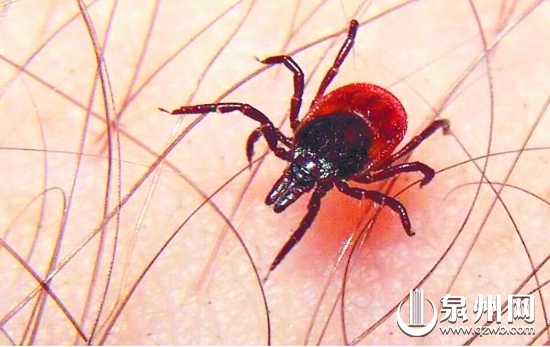 恙虫喜欢叮咬腋下、股沟、大腿内侧等易出汗的隐秘部位