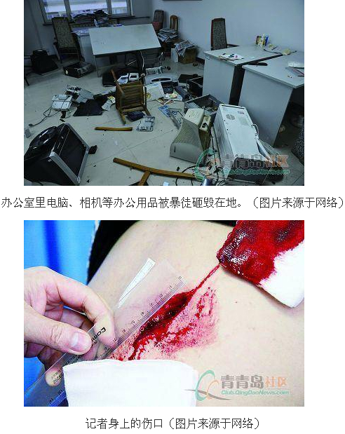 青岛曙光医院甚至为此集结歹徒打砸报社